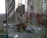 Bayi Berkepala Dua Dirawat di RSUD Arifin Ahcmad