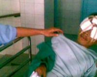 Korban Bom Cimahi Kehilangan Matanya