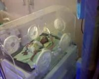 Bayi Kembar Kritis Tertahan di RS Cibabat