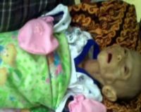 Bayi 3 Bulan Kondisinya Memburuk