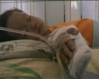 Korban Hepatitis A Makin Bertambah