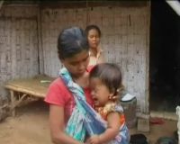 Terkendala Biaya, Bayi Hydrocepalus Merana