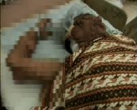 Dokter Pesimis Manusa Kutil Bisa Disembuhkan