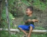Bocah Miskin Alami Penyakit Aneh