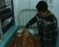 Anak Penderita Tulang Rapuh Meninggal Dunia