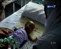 Balita Derita Gizi Buruk