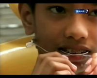 Pakai Behel, GIgi Anak Butuh Perawatan Ekstra