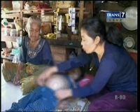 Terbelit Kemiskinan, Perut Bocah Semakin Membuncit