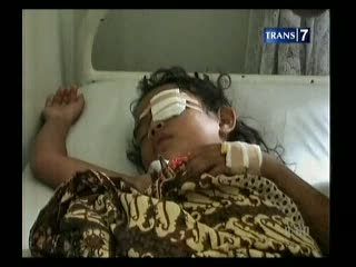 Tiga Anak Korban Pistol Mainan Dirawat di RS