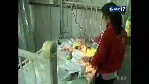 Kondisi Bayi Korban Potong Tangan Membaik