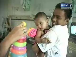 Bayi Aisyah, Korban Pengguntingan Tangan Membaik