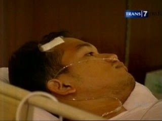 Usai Operasi Tulang Selangka, Rezky Aditya Membaik