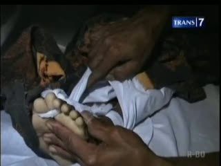 Bermain Dokter-dokteran, Anak Tewas Keracunan