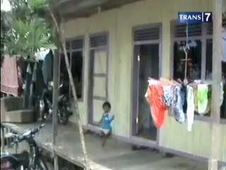 Dikira Kurang Gizi, Bocah Lumpuh Akibat Disiksa