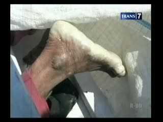 Terjerat Tali Pancing, Nelayan Tewas