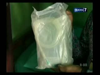Gagal Ginjal, Calon Haji Bawa Ratusan Infus