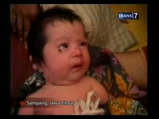 Bayi Malang Membutuhkan Bantuan