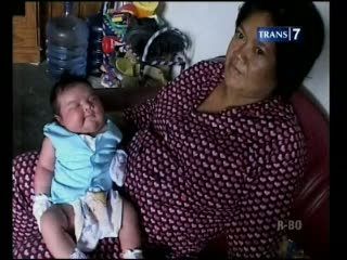  Ibu Penderita Diabetes, Berpotensi Lahirkan Bayi Jumbo