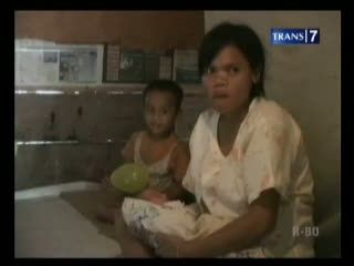 Balita Gizi Buruk Hidup di Kolong Rumah