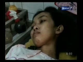 Diduga Malpraktek, Lumpuh Usai Disuntik