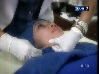 Bedah Plastik Vs Non Bedah Plastik, Pilih Mana?