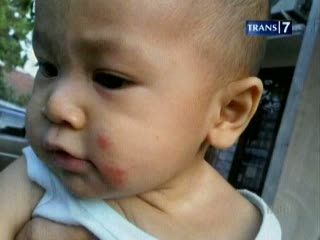 Bayi Alergi ASI, Teliti Makanan Ibu