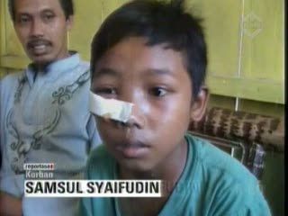 Murid SD Dianiaya Guru