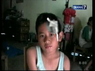 Atap Kelas Runtuh, Siswa Terluka