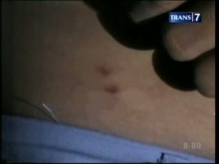 Karena Seragam, Siswa Dianiaya Kepsek