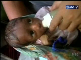 Bayi Dibuang ke Sumur Sedalam 5 Meter