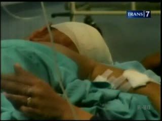 Balita Kritis Diseruduk Babi Hutan