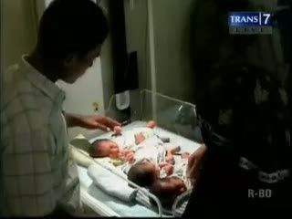 Berat Badan Kurang, Bayi Kembar 3 Dirawat intensif
