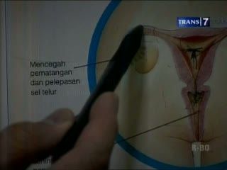 Petaka Menikah di Bawah Umur