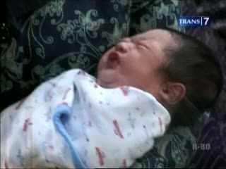 Cucu SBY Jalani Operasi