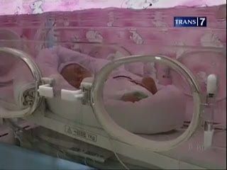 Saudara Kembar Dera Masih Dirawat