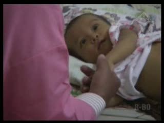 Bayi Penderita Biliary Atresia Butuh Biaya Rp 1,5 Miliar