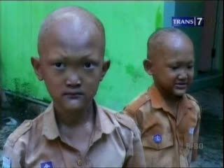 Penyakit Aneh, Fenomena Mistis atau Medis?