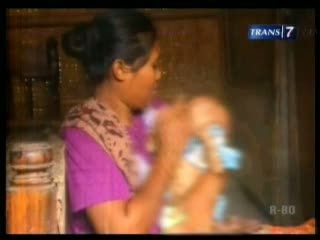 Kondisi Bayi Bersisik Mengkhawatirkan