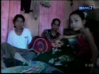 Nyeri di Kaki, Gadis ABG Lumpuh