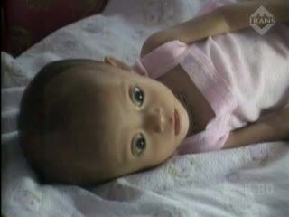 Bayi Jantung Bocor, Dirawat Seadanya