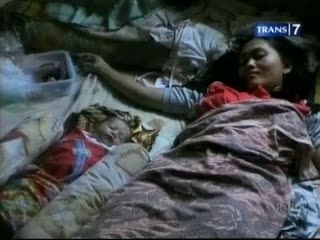 Melahirkan Tanpa Hamil, Medis atau Mistis?