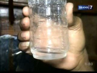 Orangtua Lalai, 3 Balita Minum Air Accu