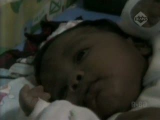 Membusuk, Jari Bayi Diamputasi