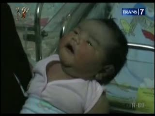 Seorang Ibu Lahirkan Bayi Jumbo