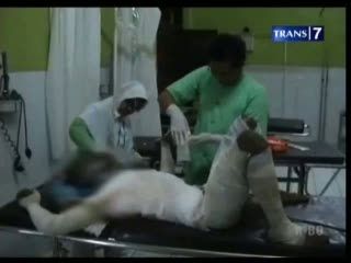 Putus Cinta, Mahasiswa Bakar Diri