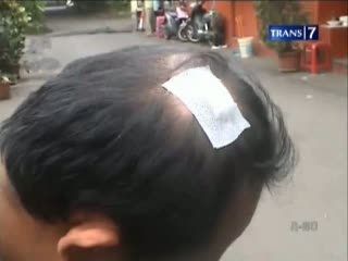 Karyawan TV Dikeroyok Anggota Ormas