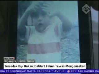Tersedak Biji Bakso, Balita 3 Tahun Tewas Mengenaskan