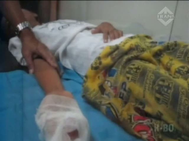 Petasan Meledak di Tangan, 3 Tulang Jari Bocah Patah