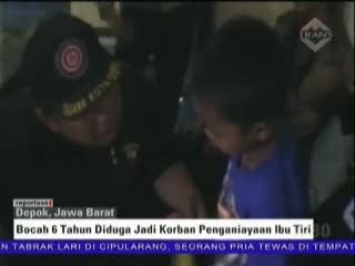 Bocah 6 Tahun Diduga Jadi Korban Penganiayaan Ibu Tiri