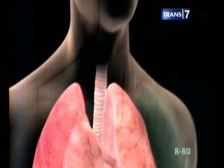 Pendarahan Paru-paru, Dul Dikabarkan Kritis